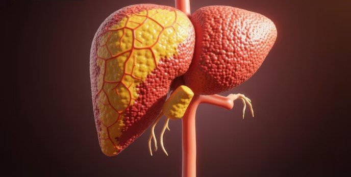 Fatty Liver Disease treatment in Pitampura